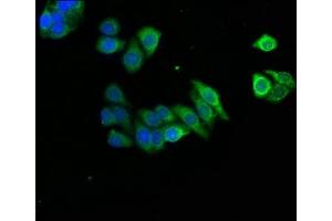Immunofluorescence staining of HepG2 cells with ABIN7143681 at 1:166, counter-stained with DAPI. (AOX1 anticorps  (AA 236-421))