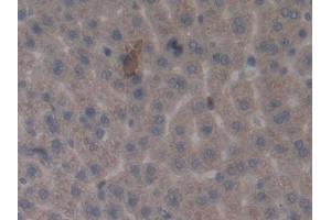 Detection of MMP3 in Rat Liver Tissue using Monoclonal Antibody to Matrix Metalloproteinase 3 (MMP3)