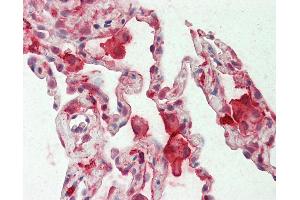 Anti-CAPG / MCP antibody IHC staining of human lung. (CAPG anticorps  (AA 205-217))