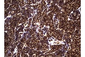 Image no. 17 for anti-Nibrin (NBN) (AA 183-460) antibody (ABIN1491058)