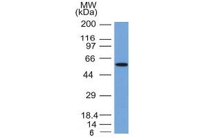 Western Blot Analysis of MCF-7 cell lysate with Occludin Mouse Monoclonal Antibody (OCLN/2181). (Occludin anticorps  (AA 282-415))