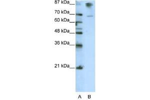 Western Blot showing HKR1 antibody used at a concentration of 1-2 ug/ml to detect its target protein. (HKR1 anticorps  (C-Term))
