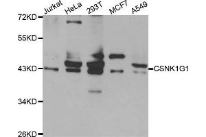 Western blot analysis of extracts of various cell lines, using CSNK1G1 antibody. (CSNK1G1 anticorps)