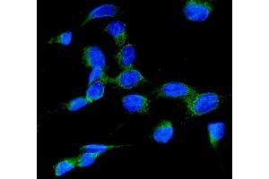 IF analysis of RAB7 using anti-RAB7 antibody (ABIN3044538). (RAB7A anticorps  (C-Term))