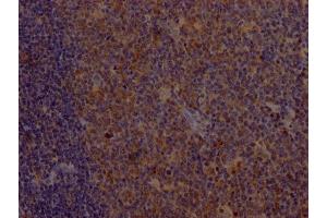 IHC image of ABIN7127410 diluted at 1:100 and staining in paraffin-embedded human tonsil tissue performed on a Leica BondTM system.