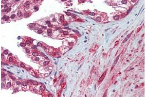 Prostate, Human: Formalin-Fixed, Paraffin-Embedded (FFPE)