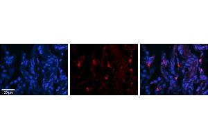 Rabbit Anti-DHX30 Antibody     Formalin Fixed Paraffin Embedded Tissue: Human Lung Tissue  Observed Staining: Cytoplasmic in alveolar type I cells  Primary Antibody Concentration: 1:100  Other Working Concentrations: 1/600  Secondary Antibody: Donkey anti-Rabbit-Cy3  Secondary Antibody Concentration: 1:200  Magnification: 20X  Exposure Time: 0.