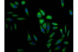 Immunofluorescence staining of Hela Cells with ABIN7127477 at 1:50, counter-stained with DAPI.