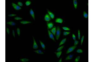 Immunofluorescence staining of Hela Cells with ABIN7127477 at 1:50, counter-stained with DAPI. (Recombinant ERK2 anticorps)