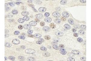 Immunohistochemistry (IHC) image for anti-Zinc Finger Protein 592 (ZNF592) (AA 950-1000) antibody (ABIN7448883) (ZNF592 anticorps  (AA 950-1000))