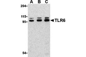 Western Blotting (WB) image for anti-Toll-Like Receptor 6 (TLR6) (Middle Region) antibody (ABIN1031130) (TLR6 anticorps  (Middle Region))