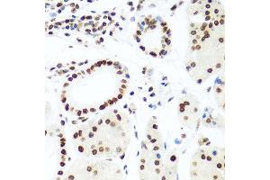Immunohistochemistry of paraffin-embedded human gastric using H2AFX antibody at dilution of 1:100 (x40 lens). (H2AFX anticorps)