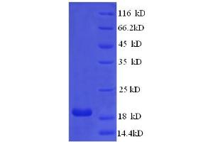 SDS-PAGE (SDS) image for Mismatch Repair Protein 2 (MSH2) (AA 139-311) protein (His tag) (ABIN5709307)