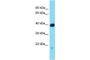 Western Blotting (WB) image for anti-Regulator of Chromosome Condensation (RCC1) and BTB (POZ) Domain Containing Protein 1 (RCBTB1) (N-Term) antibody (ABIN2790441) (RCBTB1 anticorps  (N-Term))