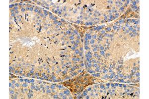 ABIN6265008 and ABIN6276582 at 1/100 staining Mouse testis tissue by IHC-P.
