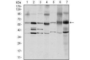 Western blot analysis using SRC mouse mAb against MCF-7 (1), A431 (2), Hela (3), HEK293 (4), NIH/3T3 (5), PC-12 (6) and Cos7 (7) cell lysate. (Src anticorps)