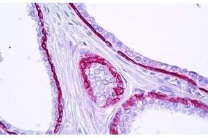 Anti-KRT15 / Cytokeratin 15 antibody IHC staining of human prostate, epithelium. (KRT15 anticorps  (AA 1-50))