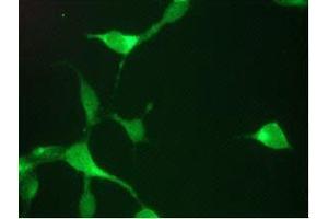 Immunofluorescent staining of LNCaP cells (Prostate Specific Antigen anticorps)