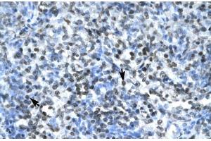 Human Spleen; CLDN17 antibody - middle region in Human Spleen cells using Immunohistochemistry (Claudin 17 anticorps  (Middle Region))