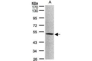 WB Image Sample(30 μg of whole cell lysate) A:293T 10% SDS PAGE antibody diluted at 1:1000 (MOK anticorps)