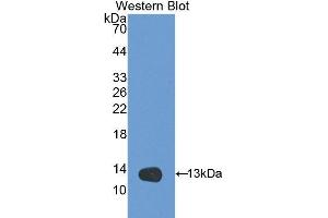Western Blotting (WB) image for anti-Serpin Peptidase Inhibitor, Clade G (C1 Inhibitor), Member 1 (SERPING1) (AA 406-476) antibody (ABIN3208983) (SERPING1 anticorps  (AA 406-476))