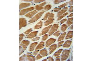 ACADL Antibody immunohistochemistry analysis in formalin fixed and paraffin embedded human skeletal muscle followed by peroxidase conjugation of the secondary antibody and DAB staining. (ACADL anticorps  (AA 292-319))