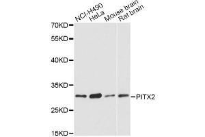 Western blot analysis of extracts of various cell lines, using PITX2 antibody (ABIN5975338) at 1:3000 dilution. (PITX2 anticorps)