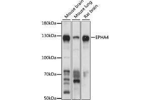 Western blot analysis of extracts of various cell lines, using EPH antibody (ABIN6132064, ABIN6140215, ABIN6140216 and ABIN6224369) at 1:1000 dilution. (EPH Receptor A4 anticorps  (AA 887-986))