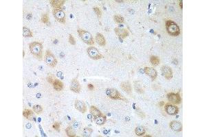 Immunohistochemistry of paraffin-embedded Mouse brain using GFM1 Polyclonal Antibody at dilution of 1:100 (40x lens).