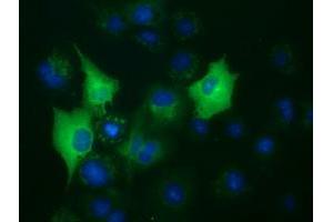 Anti-BUB1B mouse monoclonal antibody (ABIN2452850) immunofluorescent staining of COS7 cells transiently transfected by pCMV6-ENTRY BUB1B (RC205844). (BUB1B anticorps)