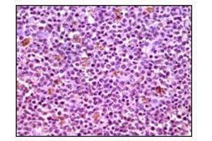 Immunohistochemical analysis of paraffin-embedded human lymphnode tissues using MCL1 mouse mAb with DAB staining.