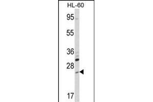 Western blot analysis of hARL6-M1 (ABIN1882064 and ABIN2839232) in HL-60 cell line lysates (35 μg/lane).