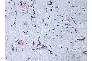 Image no. 2 for anti-Platelet Factor 4 (PF4) antibody (ABIN465152) (PF4 anticorps)