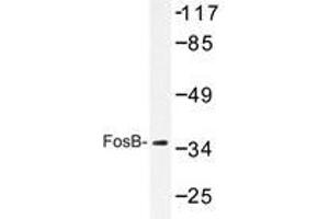 Western blot analyzes of FosB antibody in extracts from COS7 cells. (FOSB anticorps)
