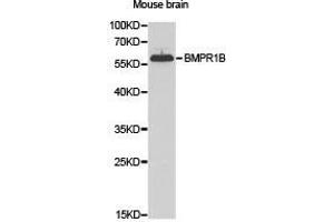 Western Blotting (WB) image for anti-Bone Morphogenetic Protein Receptor, Type IB (BMPR1B) antibody (ABIN1871327) (BMPR1B anticorps)