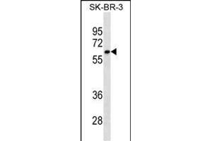 CYP1A2 Antibody ABIN1539921 western blot analysis in SK-BR-3 cell line lysates (35 μg/lane). (CYP1A2 anticorps  (AA 255-282))