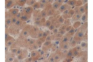 IHC-P analysis of Human Liver Tissue, with DAB staining. (LCAT anticorps  (AA 41-210))