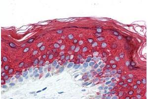 Human Skin (formalin-fixed, paraffin-embedded) stained with KRT10 antibody ABIN364279 at 10 ug/ml followed by biotinylated anti-mouse IgG secondary antibody ABIN481714, alkaline phosphatase-streptavidin and chromogen. (Keratin 10 anticorps)