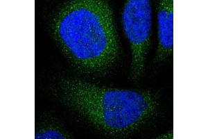 Immunofluorescent staining of U-2 OS with UBE2I polyclonal antibody  (Green) shows positivity in cytoplasm. (UBE2I anticorps)