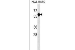 ANKDD1B Antibody (C-term) (ABIN1537327 and ABIN2850198) western blot analysis in NCI- cell line lysates (35 μg/lane). (ANKDD1B anticorps  (C-Term))