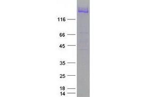 Validation with Western Blot