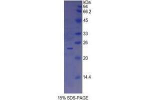 SDS-PAGE analysis of Human Insulin Like Growth Factor Binding Protein 6 (IGFBP6) Protein. (IGFBP6 Protéine)