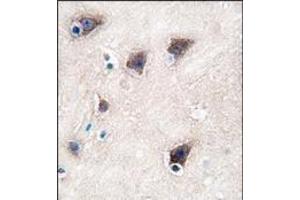 Image no. 2 for anti-Cytochrome P450, Family 2, Subfamily R, Polypeptide 1 (CYP2R1) (C-Term) antibody (ABIN360262)