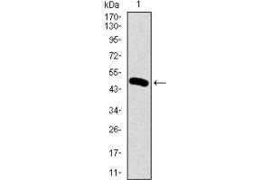 Western blot analysis using BMPR1A antibody against HEK293 (1) and BMPR1A (AA: 179-378) -hIgGFc transfected HEK293 (2) cell lysate. (BMPR1A anticorps  (AA 179-378))