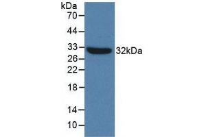 Western blot analysis of recombinant Mouse TLR4.
