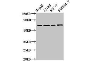 Western Blot Positive WB detected in: HepG2 whole cell lysate, A2780 whole cell lysate, MCF-7 whole cell lysate, RAW264. (PRSS8 anticorps  (AA 185-319))