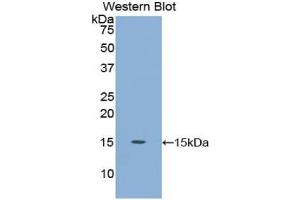 Detection of Recombinant CEA, Human using Polyclonal Antibody to Carcinoembryonic Antigen (CEA) (CEA anticorps  (AA 566-698))