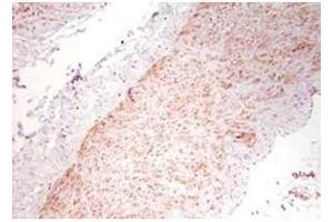 Immunohistochemistry using  polyclonal TNFa antibody showing staining of formalin/PFA-fixed paraffin-embedded sections of human artery tissue sections. (TNF alpha anticorps)