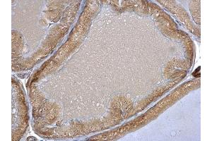 IHC-P Image HSC70 antibody detects HSC70 protein at nucleolus on mouse prostate by immunohistochemical analysis.