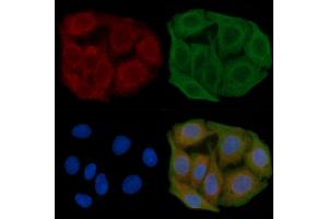 ABIN6260821 and ABIN6277548 staining Hela cells(45 min of heat-shock) by IF/ICC.
